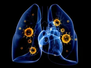 Is Lung Cancer the Only Asbestos Cancer
