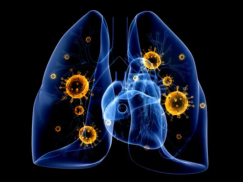 Is Lung Cancer the Only Asbestos Cancer | 800-519-1440