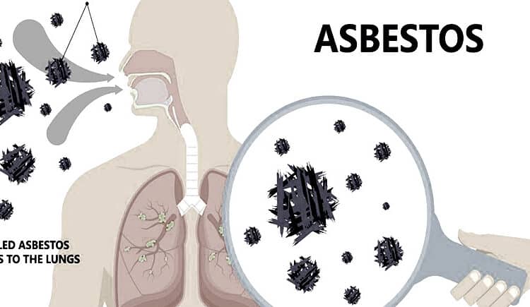  How Long Does It Take Asbestos Exposure To Affect You?