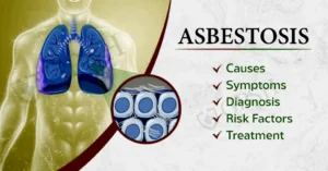 Understanding the Dangers of Asbestosis and How to Maximize Compensation if Cancer Develops